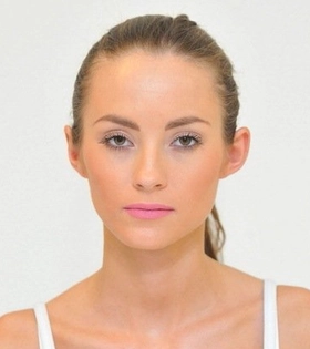 Отопластика - фото до