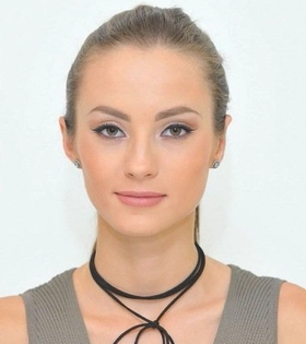 Отопластика - фото після