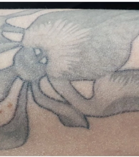 Удаление татуировки. Результат после 1 сеанса. Врач Максюта О.А. - фото до