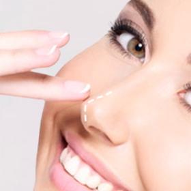 Ринопластика кінчика носа 